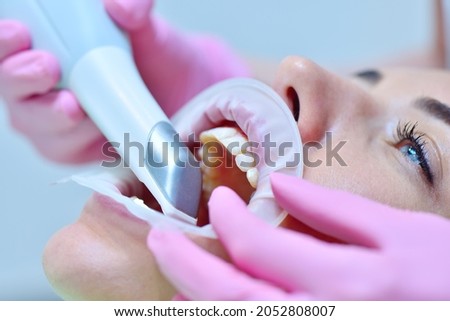 Orthodontist using 3D intraoral scanner for scanning teeth patient's. Modern dental clinic with equipment.  Dentistry and health care concept. Close up Royalty-Free Stock Photo #2052808007