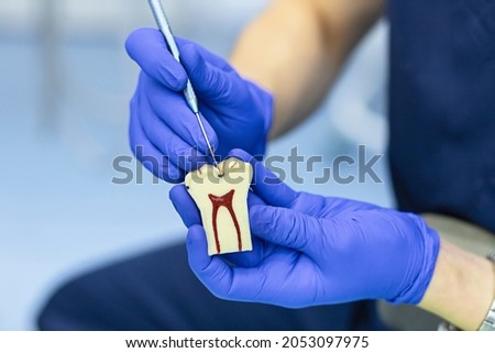 training, education, practicing dentist work. demonstration different stages caries on model on jaw for patient. mock of diseases teeth in dental clinic.  Royalty-Free Stock Photo #2053097975