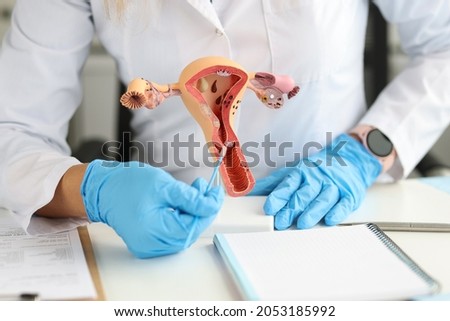 Gynecologist holds model of female reproductive system and cytological brush Royalty-Free Stock Photo #2053185992