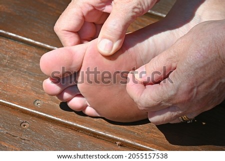 Person using a needle to get a splinter  out of their foot Royalty-Free Stock Photo #2055157538
