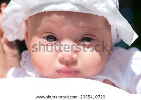 Portrait of a baby girl with blocked tear ducts of one eye Royalty-Free Stock Photo #2055410720