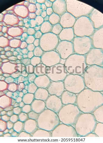 microscopic photo of DIGITALIS STEM STRUCTURE
