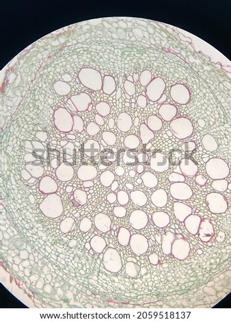 microscopic photo of helianthus plant tissue