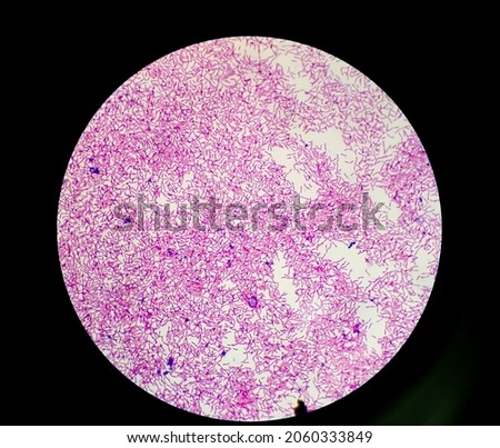 Bacteria colonies gram stain microscopic show escherichia coli, also known as E. coli, is a Gram-negative, facultative anaerobic, rod-shaped, coliform bacterium at medical laboratory. Royalty-Free Stock Photo #2060333849