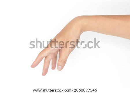 Radial nerve injury or wrist drop of Asian young man. Royalty-Free Stock Photo #2060897546