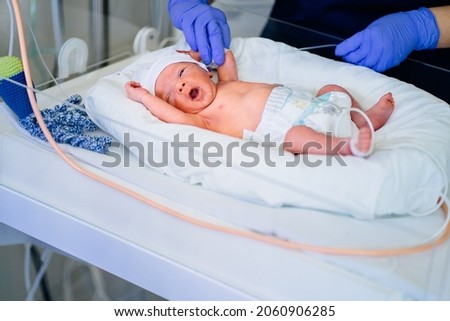 Unrecognizable nurse in blue gloves takes action and care for premature baby, selective focus on baby eye Newborn is placed in the incubator. Neonatal intensive care unit Royalty-Free Stock Photo #2060906285
