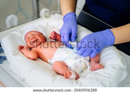 Unrecognizable nurse in blue gloves takes action and care for premature baby, selective focus on baby eye Newborn is placed in the incubator. Neonatal intensive care unit Royalty-Free Stock Photo #2060906288