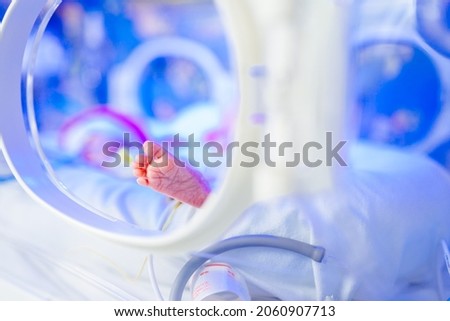 New born premature baby girl in intensive care unit in a medical incubator under ultraviolet lamp. Phototherapy treatment to reduce bilirubin levels in newborn jaundice. Neonatal icu. Royalty-Free Stock Photo #2060907713