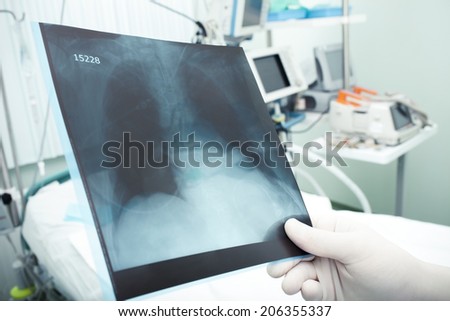Research in hospital. Doctor or medical researcher studying x-ray picture next to the bed with the patient 