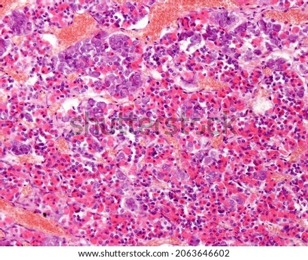 Human pituitary. Anterior lobe. Two main types of glandular cells described as acidophilic and basophilic cells. Among the cell cords, there are sinusoid capillaries of wide and irregular lumen Royalty-Free Stock Photo #2063646602