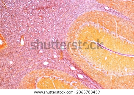 Cerebellum, Thalamus, Medulla oblongata, Spinal cord and Motor Neuron human under the microscope in Lab. Royalty-Free Stock Photo #2065783439