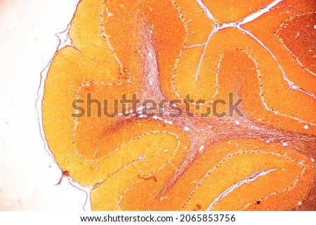 Cerebellum, Thalamus, Medulla oblongata, Spinal cord and Motor Neuron human under the microscope in Lab. Royalty-Free Stock Photo #2065853756