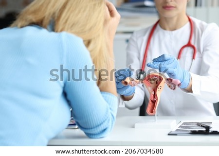 Gynecologist shows ligation of fallopian tubes to patient closeup Royalty-Free Stock Photo #2067034580