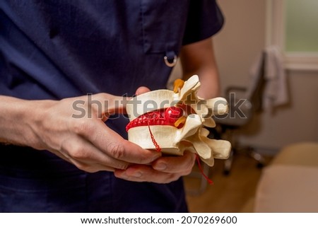 The osteopathic doctor holds in his hand a model of the spine with a hernia. Medicine. High quality photo