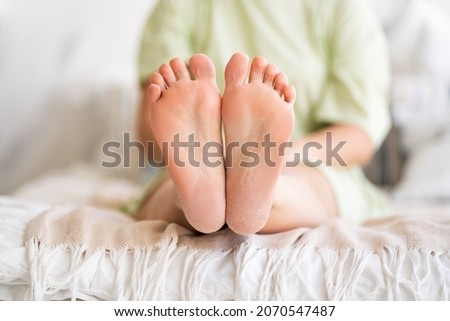 Woman relaxing in bedroom, female feet with dry cracked skin close-up, foot care concept, home interior Royalty-Free Stock Photo #2070547487