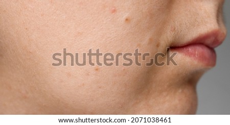 The woman has a mustache above her upper lip, close-up of black facial hair. Health problem, improper care.