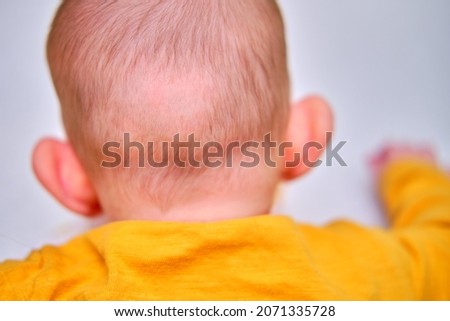 Bald spot on the back of the infant baby head. Rubbed hair of the toddler child Royalty-Free Stock Photo #2071335728