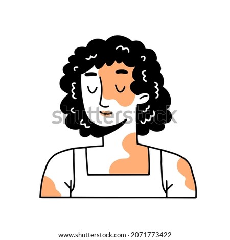 Happy African woman with vitiligo. Female character with pigmentation. Vector illustration in linear doodle style.