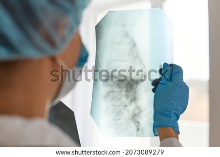 Closeup back side shot of woman doctor in medical cap and blue gloves, radilogist holding x-ray, holding radiology picture, thinking about illness and its trreatment, health care.