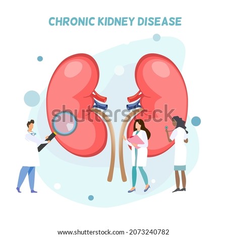 Group of doctors doing activities around human kidneys, diagnosis o about kidney disease, chronic kidney disease, long term illness, a lady doctor using stethoscope, a doctor holding magnifying glass Royalty-Free Stock Photo #2073240782