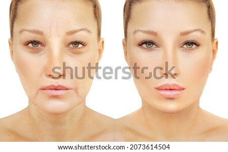 Aging. Mature woman-young woman.Face with skin problem.Showing photos before and after Royalty-Free Stock Photo #2073614504