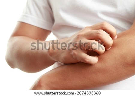 Health problems, man has itchy hands Royalty-Free Stock Photo #2074393360