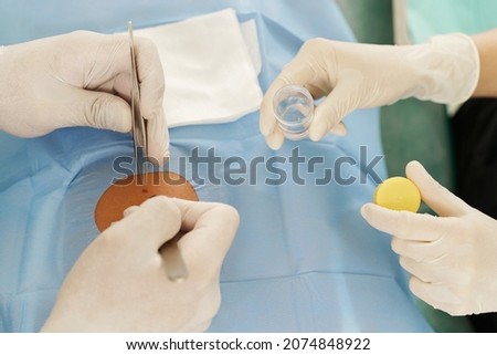 Doctor and nurse during birthmark removal dermatologic surgery in aesthetic medical clinic Royalty-Free Stock Photo #2074848922
