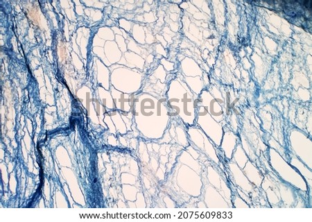 Areolar connective tissue under the light microscope view. Human pathology education. Haematoxylin and eosin staining technique. Royalty-Free Stock Photo #2075609833