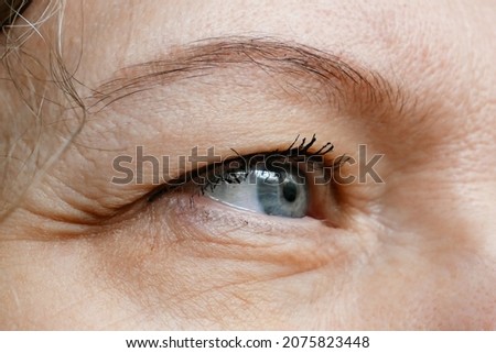 middle-aged woman does corrective eye makeup to correct the drooping eyelid. Ptosis is a drooping of the upper eyelid, lazy eye. Cosmetology and facial concept, closeup Royalty-Free Stock Photo #2075823448