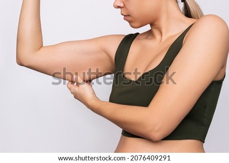 Cropped shot of a young caucasian blonde woman grabbing skin on her upper arm with excess fat isolated on a gray background. Pinching the loose and saggy muscles. Taking care of the body Royalty-Free Stock Photo #2076409291