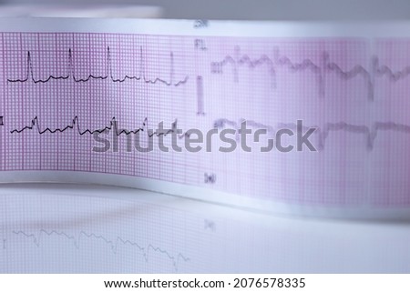 Close-up of a graph paper strip with black heart waves forming an electrocardiogram. Concept of study or medical test. Selective focus