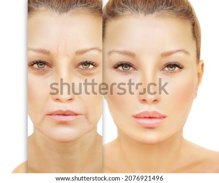 Aging. Mature woman-young woman.Face with skin problem.Showing photos before and after Royalty-Free Stock Photo #2076921496