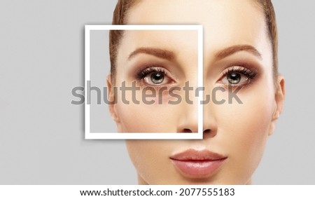 Lower  Blepharoplasty. plastic surgery concept. Royalty-Free Stock Photo #2077555183