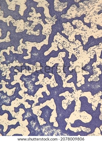 microscopic photo of gram positive bacteria on slide