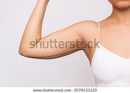 Cropped shot of a young woman with excess fat on her upper arm with marks for liposuction or plastic surgery isolated on a gray background. The loose and saggy muscles. Overweight. Beauty concept Royalty-Free Stock Photo #2078535220