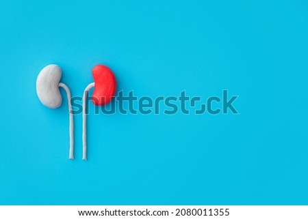 concept - kidney disease, pyelonephritis, renal colic, kidney inflammation. Royalty-Free Stock Photo #2080011355