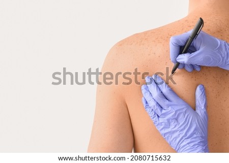 Dermatologist examining patient on light background Royalty-Free Stock Photo #2080715632