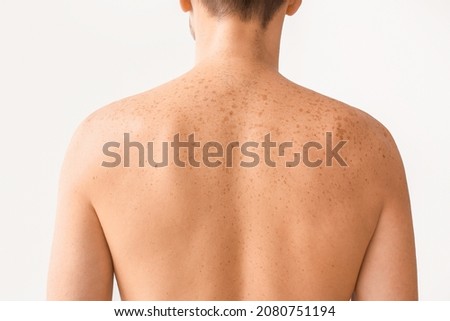 Man with freckles on light background Royalty-Free Stock Photo #2080751194