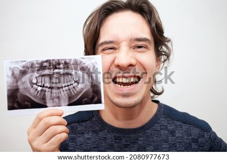 X-ray of teeth picture. man smiles, opens his mouth. Poses, portrait. isolated