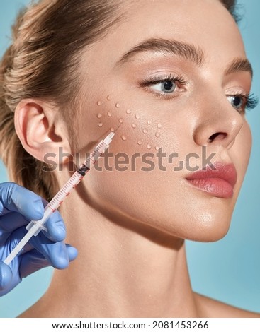 Biorevitalization. Beautiful woman getting beauty injections with hyaluronic acid for smoothing of face mimic wrinkles. Anti-aging procedure Royalty-Free Stock Photo #2081453266
