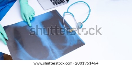 The X-ray picture is on the table. The stethoscope and the hands of the physician show pneumonia in the picture with the lungs