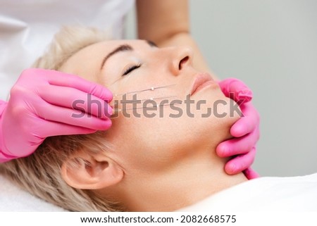 Thread lifting procediure. Professional cosmetologist in pink medical gloves holding needles near cheek. Close up face of adult pretty woman. Royalty-Free Stock Photo #2082668575