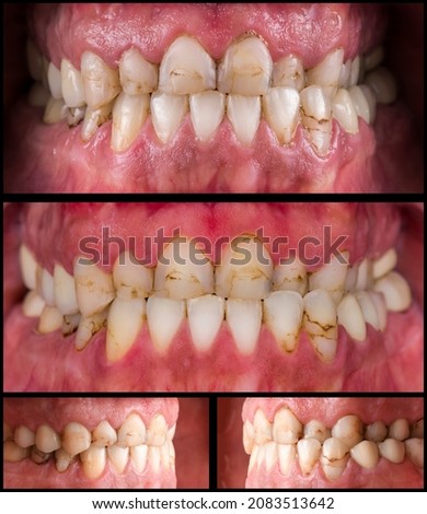dental high magnification pictures  before starting dental treatment