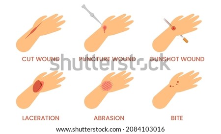 LACERATION Stock Vector Images - Avopix.com