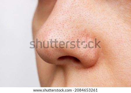 Close-up of a woman's nose with blackheads or black dots isolated on a white background. Acne problem, comedones. Enlarged pores on the face. Cosmetology dermatology concept Royalty-Free Stock Photo #2084653261