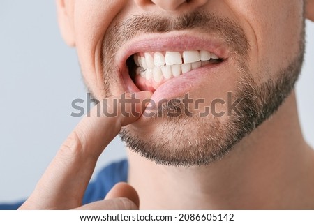 Man suffering from tooth ache, closeup Royalty-Free Stock Photo #2086605142