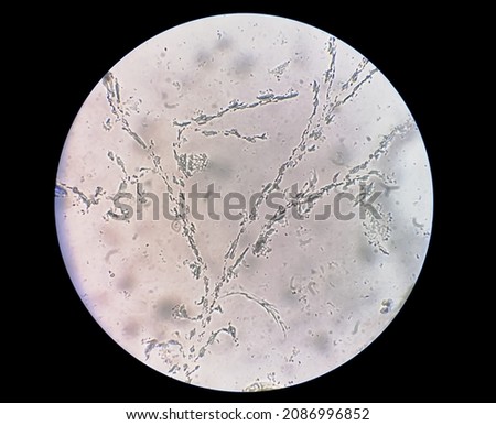 Microscopic view of dermatophytes, Nail scraping for fungus test Royalty-Free Stock Photo #2086996852