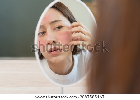 Dermatology, puberty asian young woman, girl looking into mirror, allergy presenting an allergic reaction from cosmetic, red spot or  rash on face. Beauty care from skin problem by medical treatment. Royalty-Free Stock Photo #2087585167