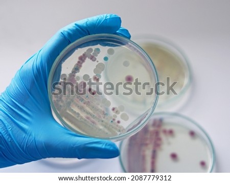 Researcher is holding Petri dish of Vibrio vulnificus in CHROMagar and TCBS, an estuarine bacterium which occurs in in filter-feeding molluscan shellfish, such as oysters., ingestion of the bacterium. Royalty-Free Stock Photo #2087779312
