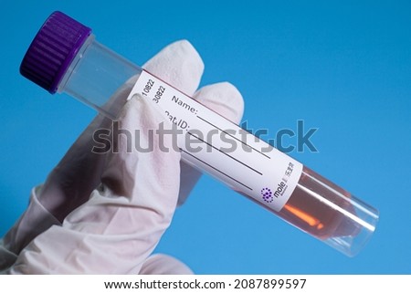 Covid-19 viral health check, coronavirus global pandemic outbreak crisis, rapid antigen detection test, serological analysis of the patient's first antibody sample